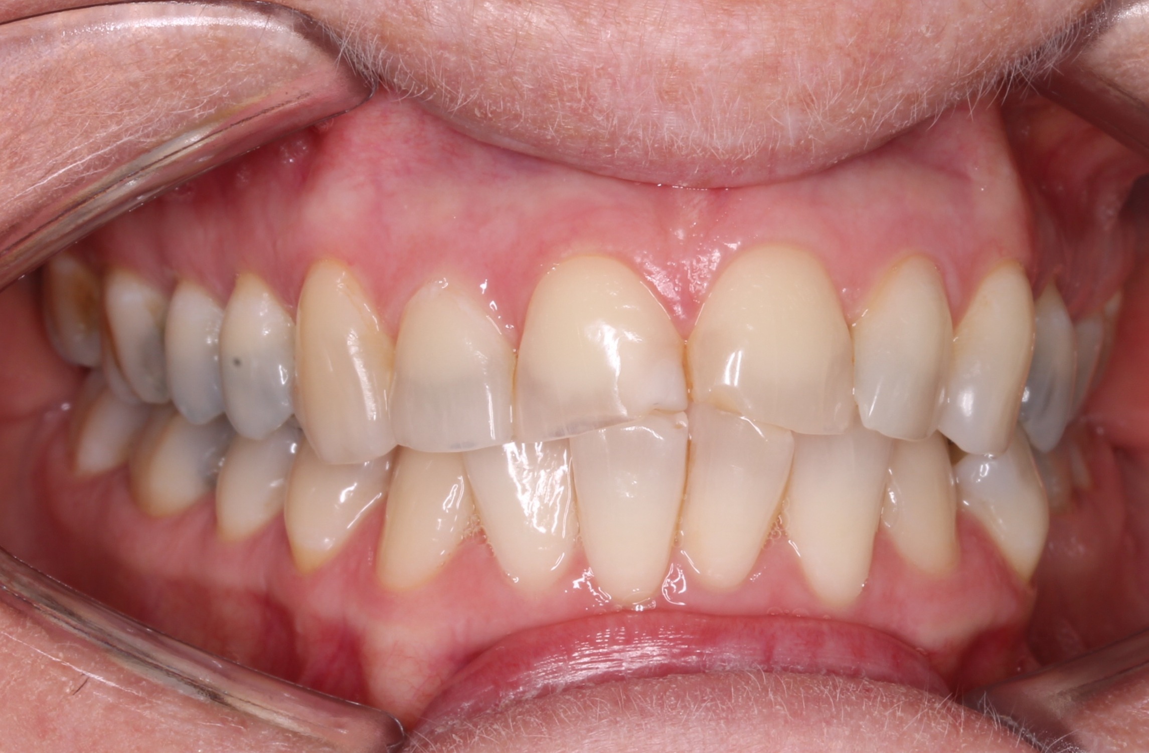 before Image