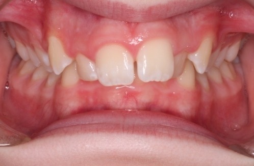 before Image