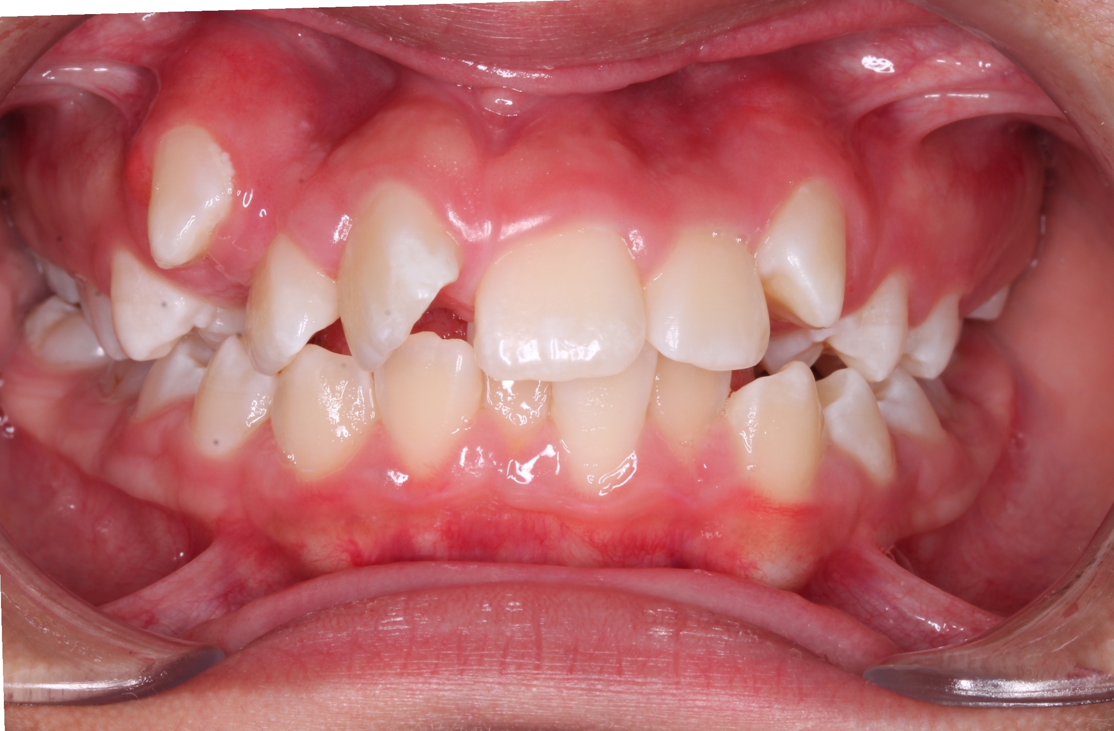 before Image