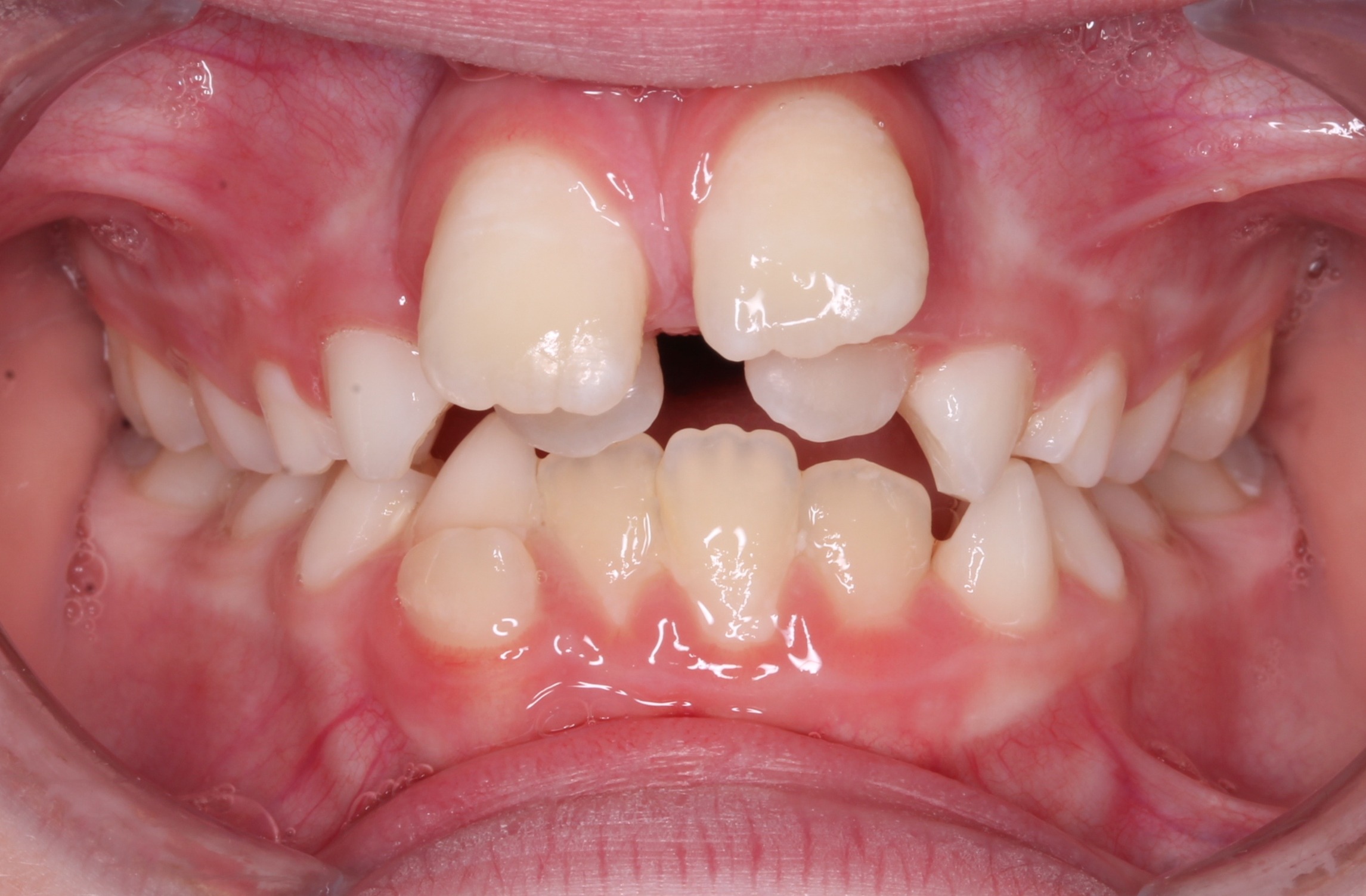 before Image