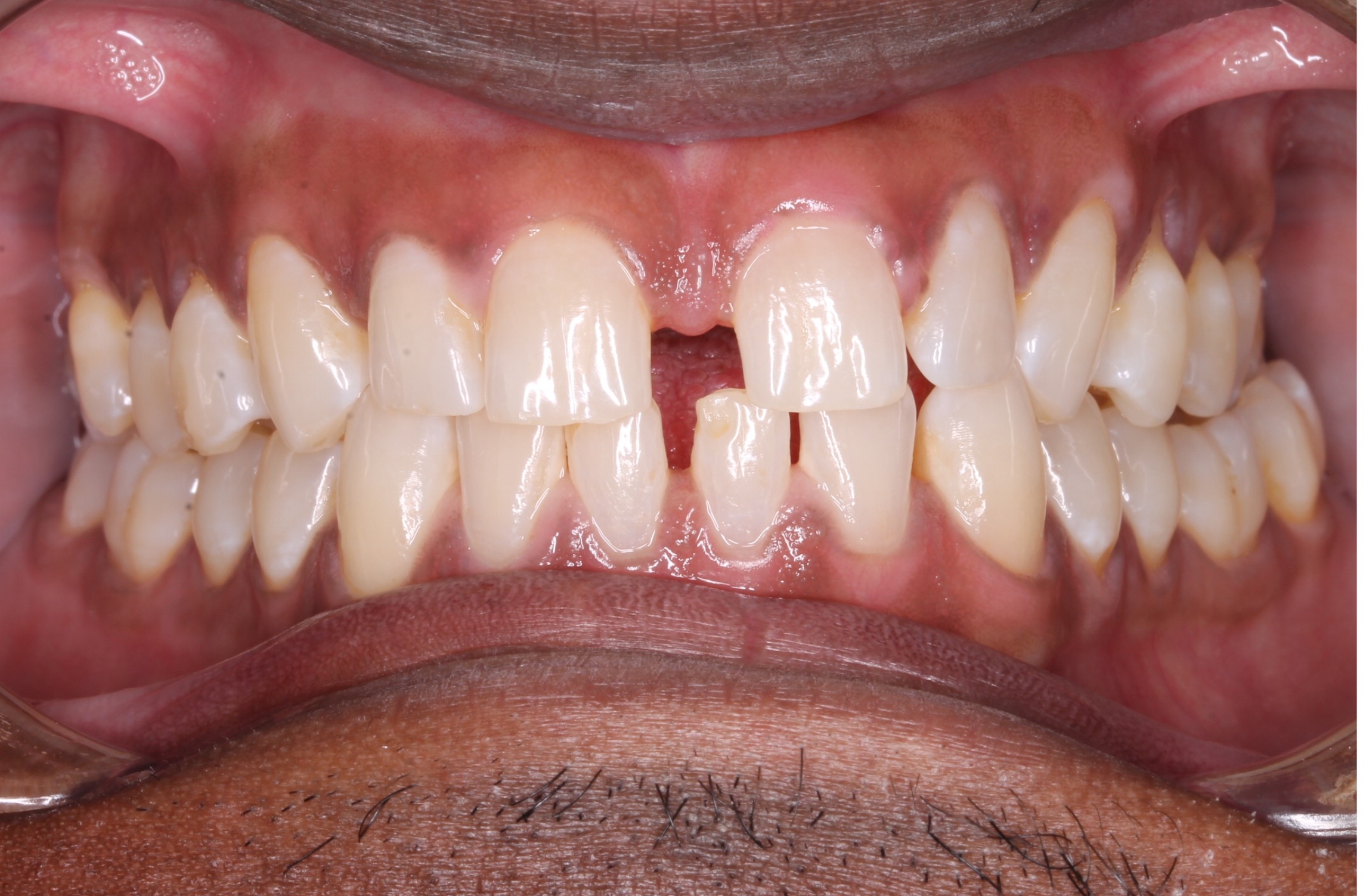 before Image