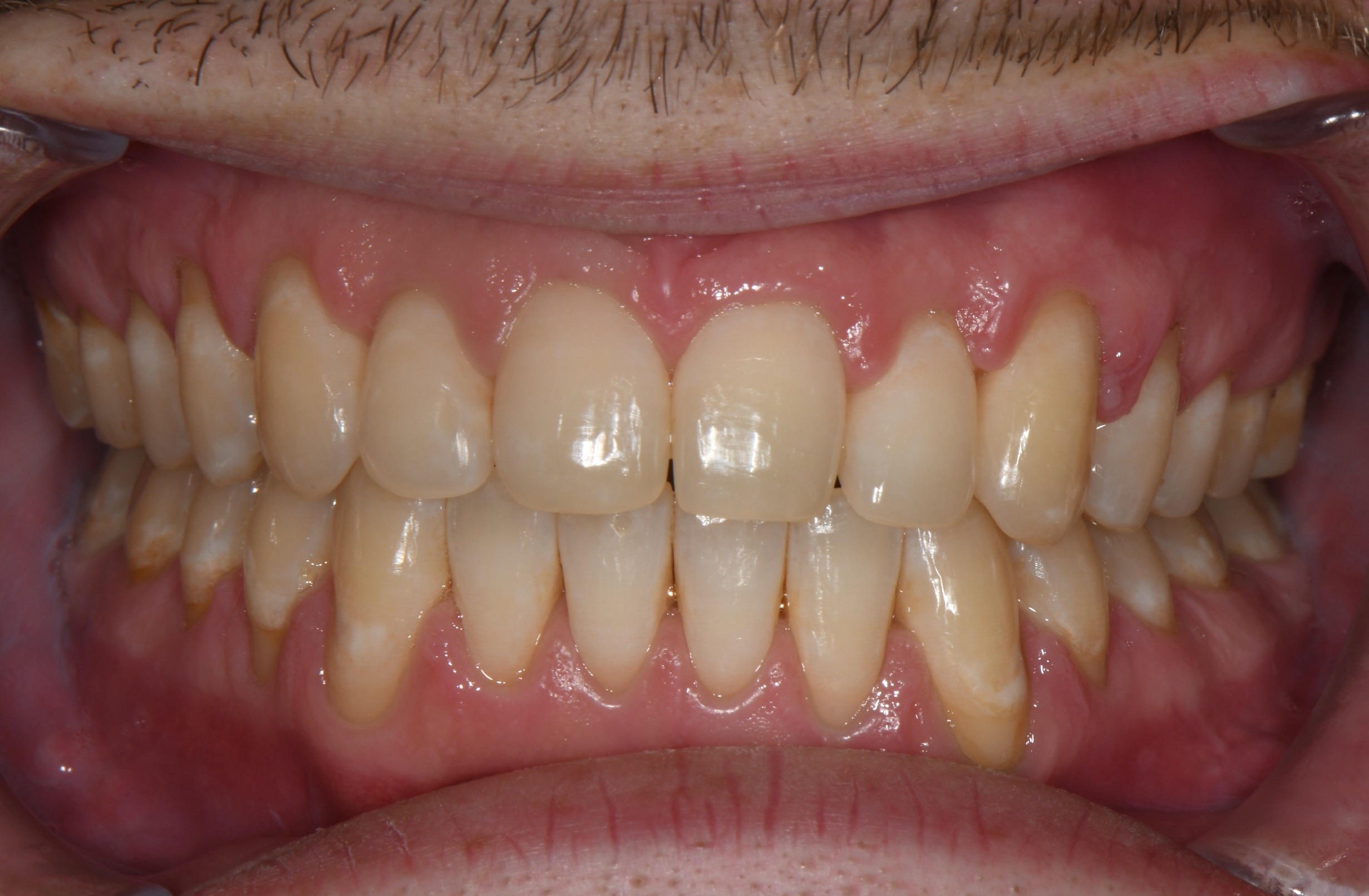 after Image