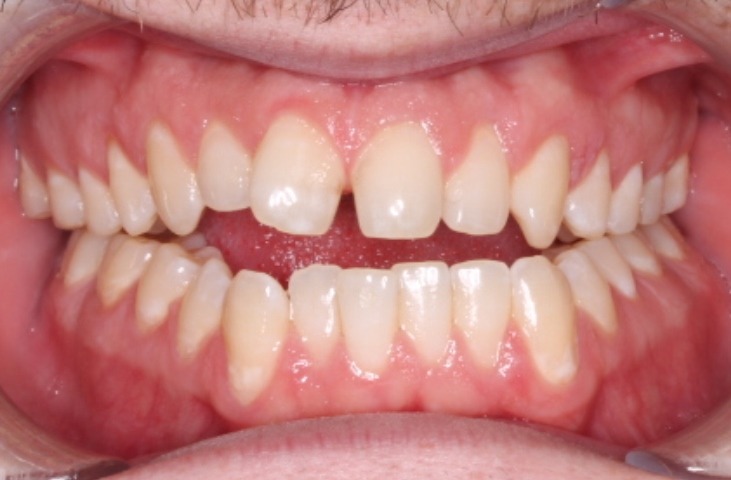 before Image