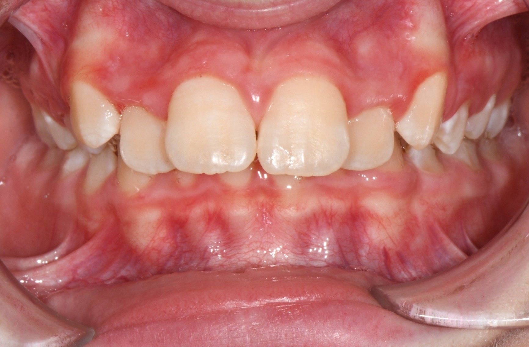 before Image